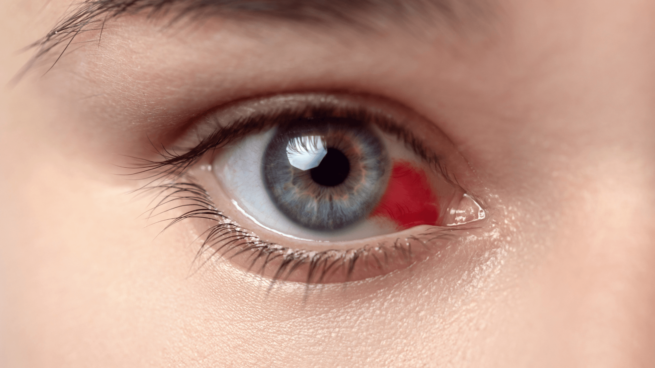 why-do-i-have-bloodshot-eyes-total-eye-care