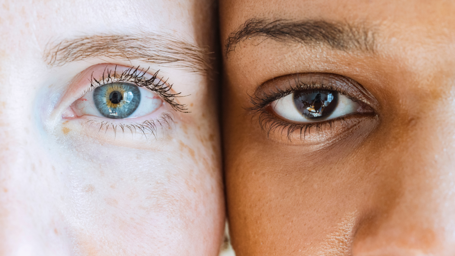 why-do-we-have-different-eye-colors-total-eye-care