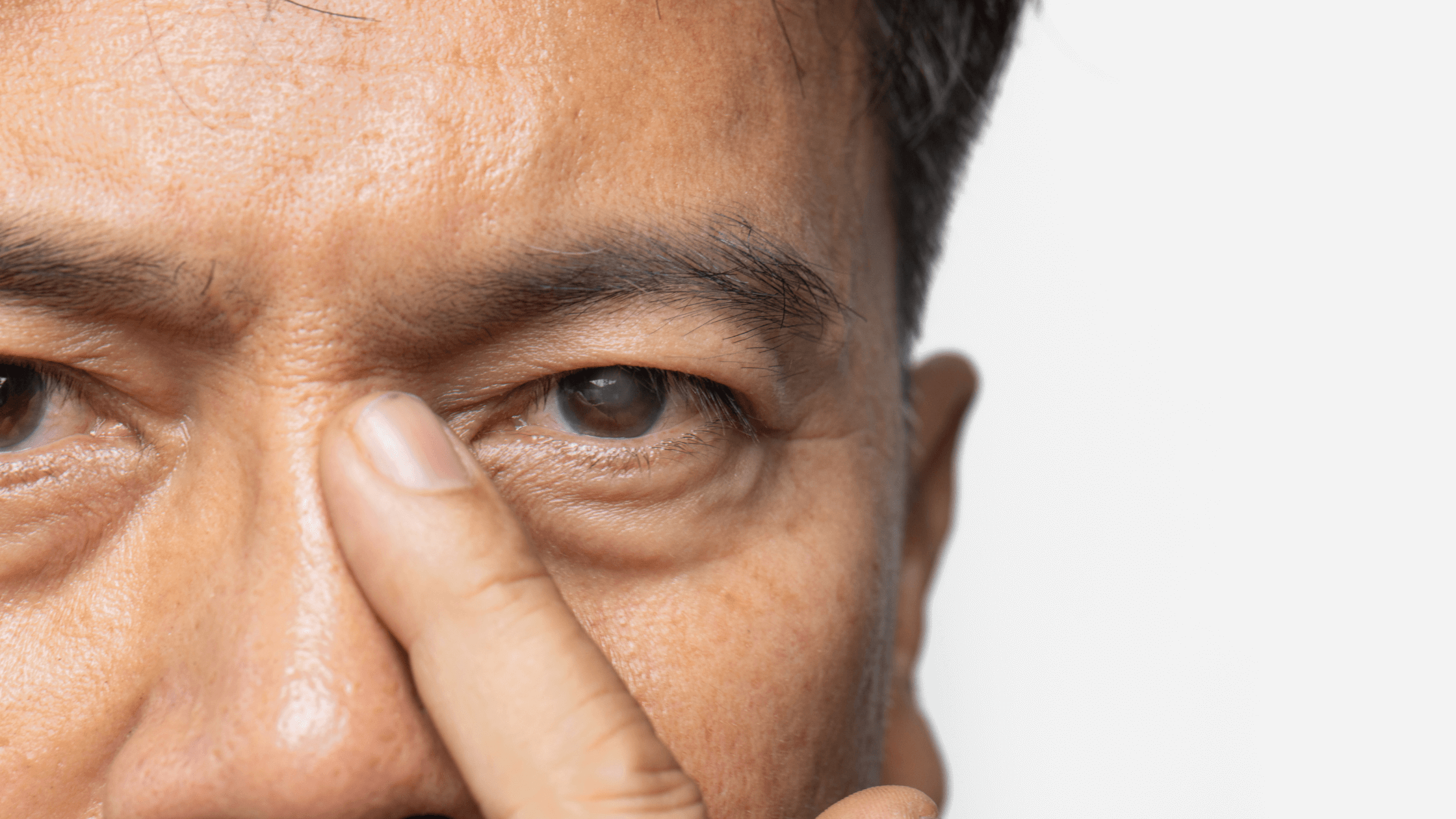 Man holding eyes, experiencing cataract symptoms
