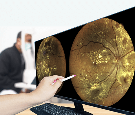 Eye doctor reviewing retinal screening results for a patient with diabetes