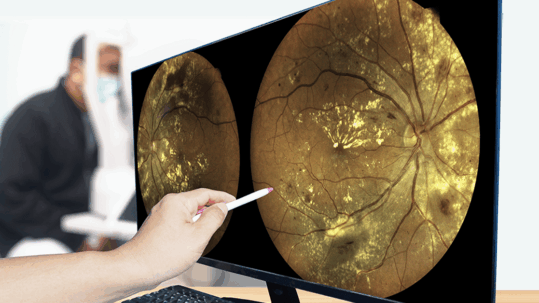 Optometrist reviewing retinal imaging during a diabetic eye exam in Billings MT