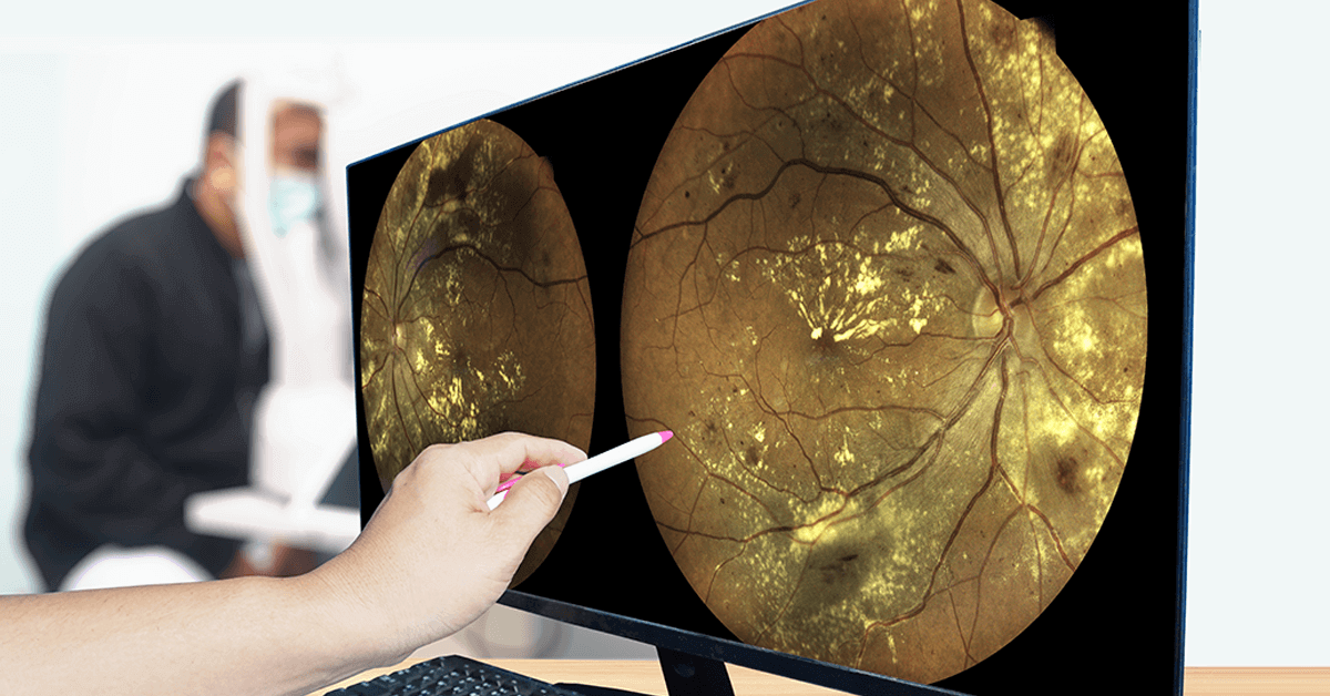 Optometrist reviewing retinal imaging during a diabetic eye exam in Billings MT